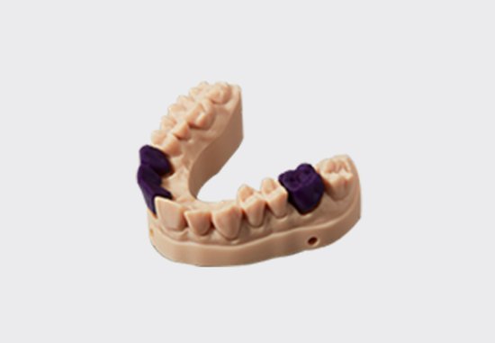 Dental Casting Resin Dental Casting Resin